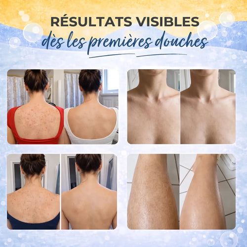 Serviette de douche exfoliante antibactérienne à poignées – 120 cm